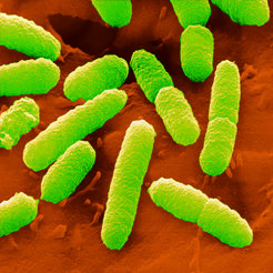 Mikroskopaufnahme von <em>Escherichia coli</em>