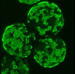 Influenza virus-infected MDCK cells on microcarrier