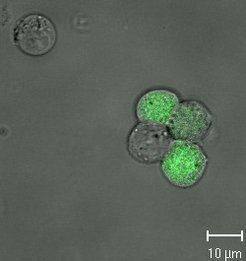 Laser-scanning microscope picture (LSM 510, Zeiss, 100x) of AGE1.CR.pIX cells expressing GFP after infection with MVA-egfp (cells which are infected and produce virus are green).