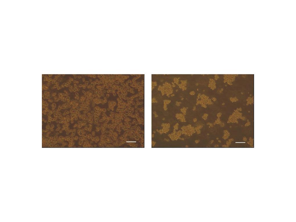 Lichtmikroskopische Aufnahmen von AGE1.CR (links) und AGE1.CRpIX Zellen (rechts). Die Aufnahmen stammen aus 24 Stunden alten T-Flaschen-Kulturen. Die CR Zellen zeigten nach der gleichen Kultivierungsdauer höhere Zellkonzentrationen und einen geringeren Aggregationsgrad in der unbewegten Kultur als CR.pIX Zellen. Der Balken gibt eine Länge von 100µm an.