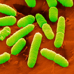 Mikroskopaufnahme von Escherichia coli
