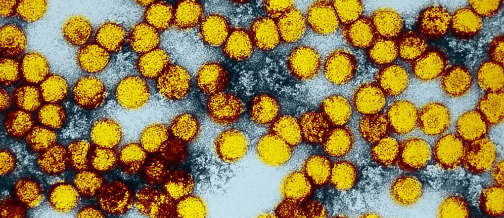 Yellow fever viruses under an electron microscope. Researchers at the Max Planck Institute for Dynamics of Complex Technical Systems are multiplying the pathogens in bioreactors. This technique could soon also be used in the production of vaccines.