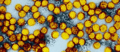 Yellow fever viruses under an electron microscope. Researchers at the Max Planck Institute for Dynamics of Complex Technical Systems are multiplying the pathogens in bioreactors. This technique could soon also be used in the production of vaccines.