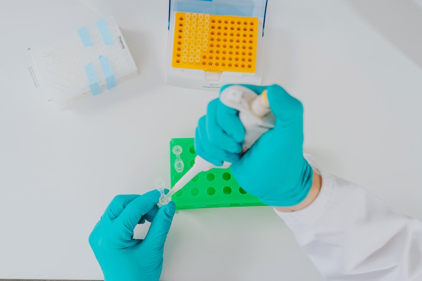 Elucidation of Glycosylation Patterns of Recombinant Glycoproteins for Production, Process Control and Optimization