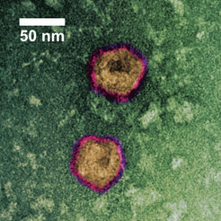 Die im Bild gezeigten Corona-virusähnlichen Partikel (VLPs) wurden mit der innovativen sterischen Ausschlusstechnologie von ContiVir gereinigt.Transmissionselektronenmikroskopie (TEM) mit Negativkontrastierung