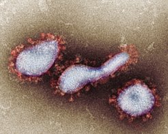 SARS-CoV-2-Partikel, die mit der sterischen Ausschlusstechnik von ContiVir gereinigt und in präklinischen Versuchen getestet wurden. Die antigenen Spike-Proteine sind auf der Oberfläche der Virionen deutlich sichtbar, hier durch Transmissionselektronenmikroskopie dargestellt.
